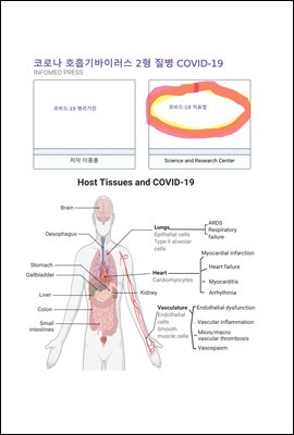 코로나 호흡기바이러스 2형 질병 (COVID-19) 치료 기전 : 코비드-19에 감염되면 아스피린과 답손을 투약해라 진행되면 덱사메타존을 추가해라